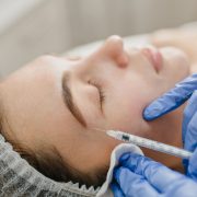 Las inyecciones de bioestimuladores en la piel del rostro promete regalarnos varios importantes beneficios.