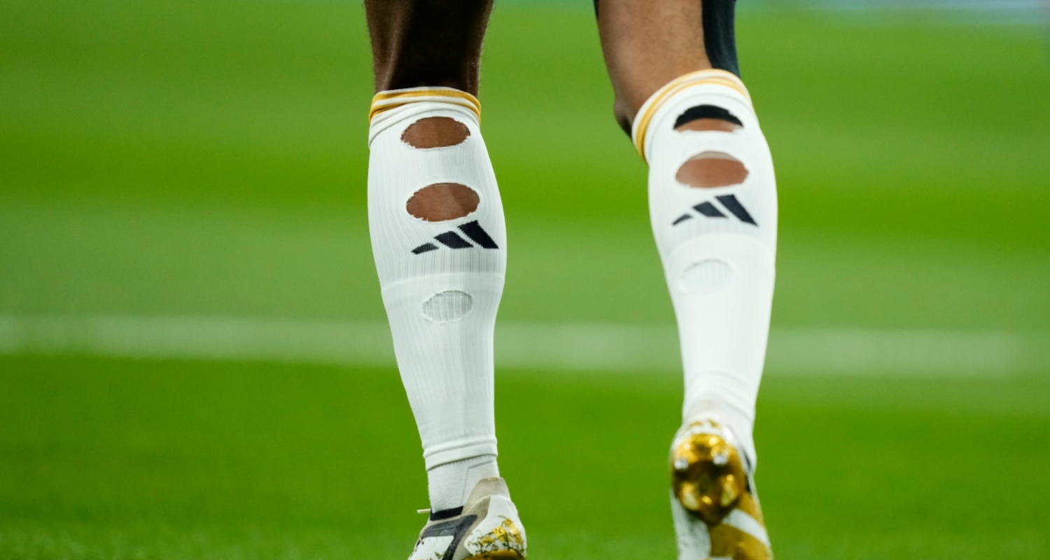 ¿Por qué los jugadores del Mundial 2026 están jugando con calcetines rotos?